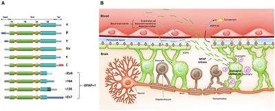 Glial Fibrillary Acidic Protein in Blood as a Disease Biomarker of Neuromyelitis Optica Spectrum Disorders